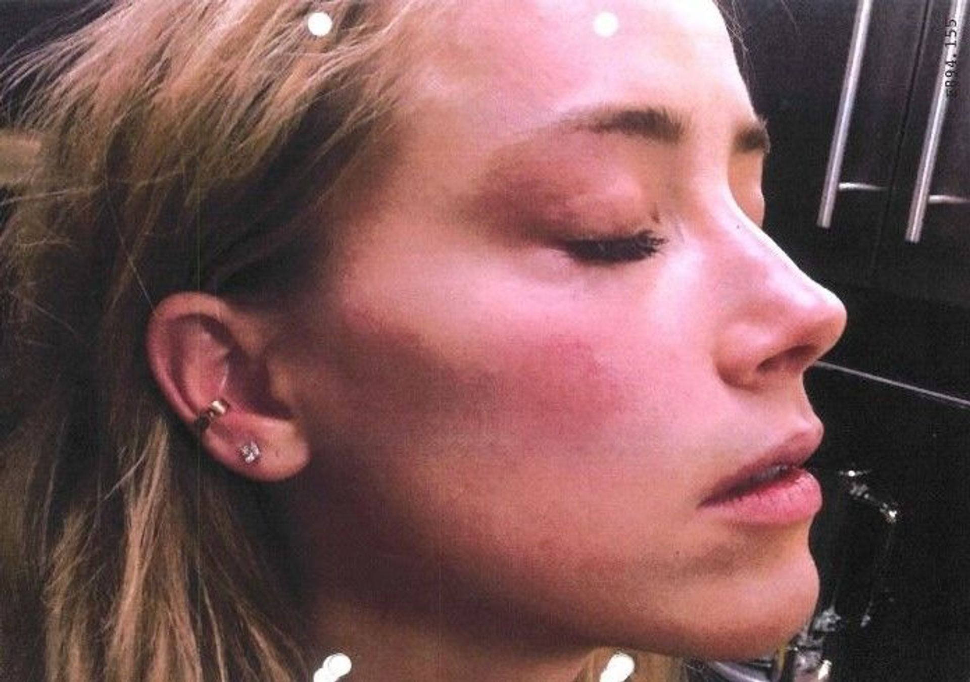 Amber Heard has been accused of fabricating her injuries - Sputnik International, 1920, 04.05.2022