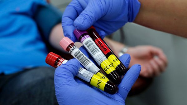 Blood samples donated by recovered novel coronavirus patients for plasma extraction, contributing to Israel's new experimental antibodies treatment, are collected by Magen David Adom’s Blood Services in Sheba Medical Center Hospital near Tel Aviv, on June 1, 2020. Blood samples donated by recovered novel coronavirus patients for plasma extraction, contributing to Israel's new experimental antibodies treatment, are collected by Magen David Adom’s Blood Services in Sheba Medical Center Hospital near Tel Aviv, on June 1, 2020. - Sputnik International