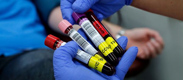 Blood samples donated by recovered novel coronavirus patients for plasma extraction, contributing to Israel's new experimental antibodies treatment, are collected by Magen David Adom’s Blood Services in Sheba Medical Center Hospital near Tel Aviv, on June 1, 2020. Blood samples donated by recovered novel coronavirus patients for plasma extraction, contributing to Israel's new experimental antibodies treatment, are collected by Magen David Adom’s Blood Services in Sheba Medical Center Hospital near Tel Aviv, on June 1, 2020. - Sputnik International
