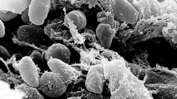 Scanning electron micrograph depicting a mass of Yersinia pestis bacteria - Sputnik International