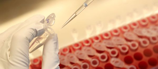 A scientist dilutes samples during the research and development of a vaccine against the coronavirus disease (COVID-19) at a laboratory of BIOCAD biotechnology company in Saint Petersburg, Russia June 11, 2020 - Sputnik International