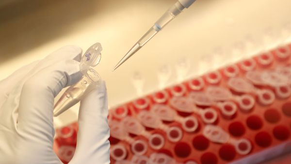 A scientist dilutes samples during the research and development of a vaccine against the coronavirus disease (COVID-19) at a laboratory of BIOCAD biotechnology company in Saint Petersburg, Russia June 11, 2020 - Sputnik International