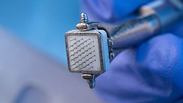The cortical implant and microchip for the Gennaris Bionic Eye, a vision-restoring device developed at Australia's Monash University - Sputnik International