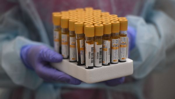 Testing for COVID-19 antibodies in Moscow, Russia - Sputnik International