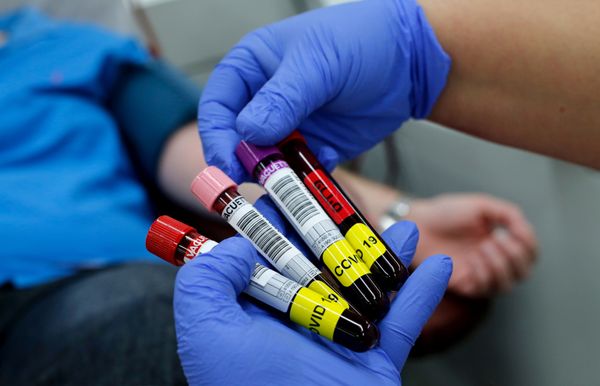 Herd Immunity to COVID-19 Possible After 3-10% of Population Get Sick, Russian Scientists Say - Sputnik International