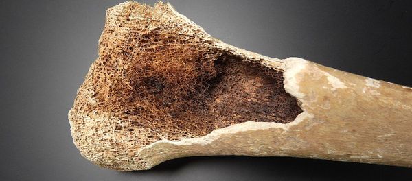 Detail of bone tissue - Sputnik International