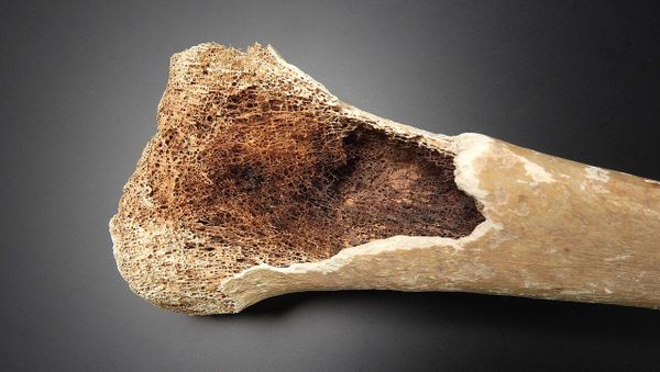 Detail of bone tissue - Sputnik International