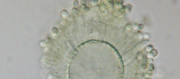 Aspergillus flavus - Sputnik International