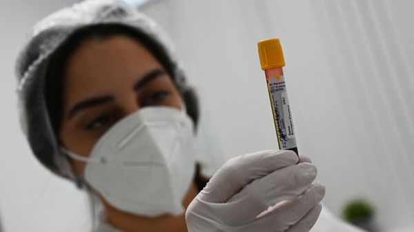 Evaluation of Sputnik V Vaccine Effectiveness in the Gemotest Laboratory in Moscow, Russia - Sputnik International