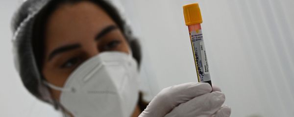 Evaluation of Sputnik V Vaccine Effectiveness in the Gemotest Laboratory in Moscow, Russia - Sputnik International