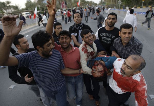 An unidentified Bahraini anti-government protester is carried to a vehicle to be taken to hospital after being wounded during a demonstration in Manama, Bahrain, Friday, 18 February 2011 An unidentified Bahraini anti-government protester is carried to a vehicle to be taken to hospital after being wounded during a demonstration in Manama, Bahrain, Friday, 18 February 2011 - Sputnik International
