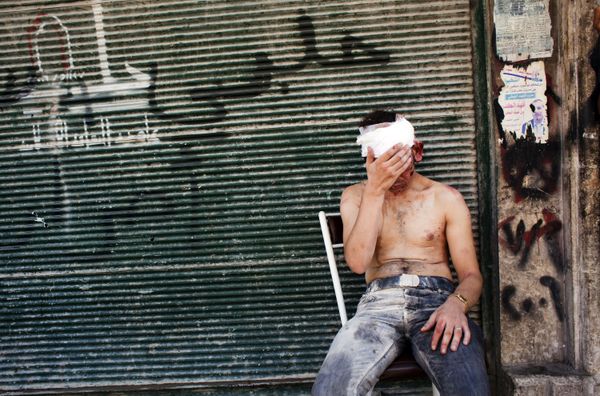 In this file photo taken on 4 September 2012, a Syrian man wounded by shelling sits on a chair outside a closed shop in the Al-Muasalat area in Aleppo In this file photo taken on 4 September 2012, a Syrian man wounded by shelling sits on a chair outside a closed shop in the Al-Muasalat area in Aleppo - Sputnik International