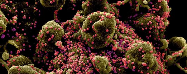 Colourized scanning electron micrograph of an apoptotic cell (greenish-brown) heavily infected with SARS-COV-2 virus particles (pink), also known as novel coronavirus, isolated from a patient sample. Image captured and colour-enhanced at the NIAID Integrated Research Facility (IRF) in Fort Detrick, Maryland. - Sputnik International