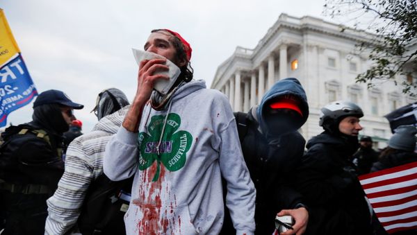 SENSITIVE MATERIAL. THIS IMAGE MAY OFFEND OR DISTURB An injured supporter of U.S. President Donald Trump reacts during a protest against the certification of the 2020 U.S. presidential election results by the U.S. Congress, outside the U.S. Capitol in Washington, U.S., January 6, 2021 SENSITIVE MATERIAL. THIS IMAGE MAY OFFEND OR DISTURB An injured supporter of U.S. President Donald Trump reacts during a protest against the certification of the 2020 U.S. presidential election results by the U.S. Congress, outside the U.S. Capitol in Washington, U.S., January 6, 2021 - Sputnik International