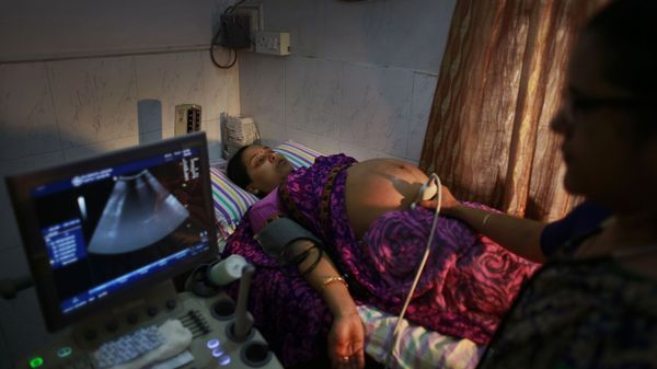 n Indian pregnant woman is examined by her gynecologist at a hospital in Gauhati, India, Friday, July 11, 2014 n Indian pregnant woman is examined by her gynecologist at a hospital in Gauhati, India, Friday, July 11, 2014 - Sputnik International