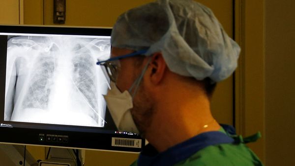 Medical workers in protective suits attend to coronavirus disease (COVID-19) patients  - Sputnik International