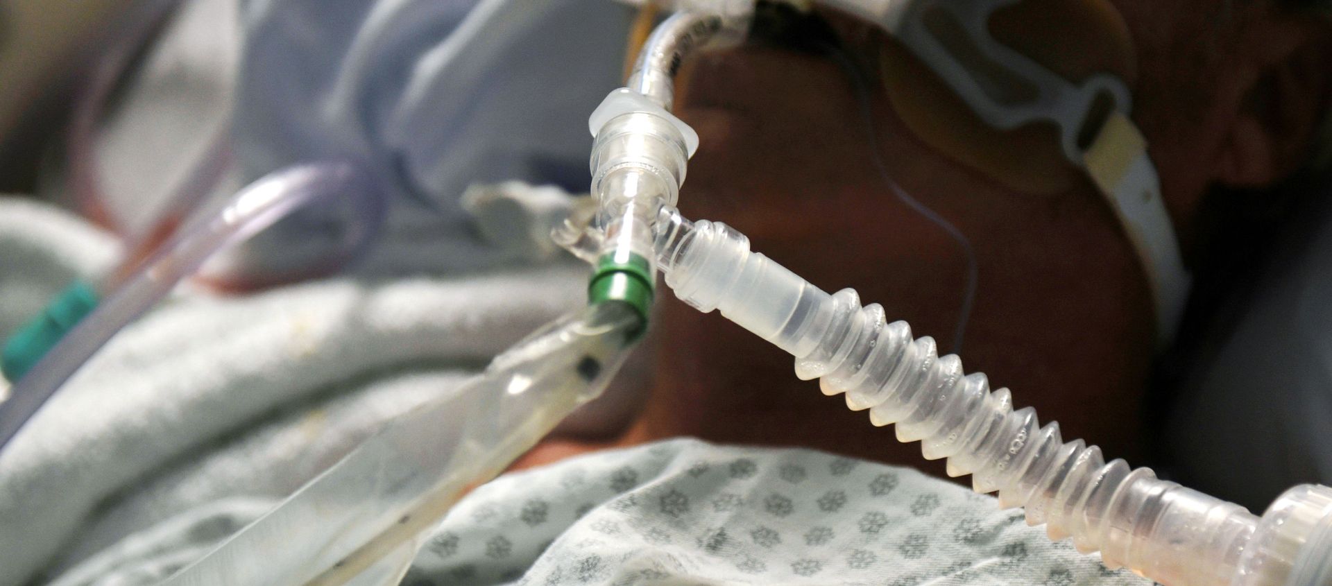FILE PHOTO: A patient on a ventilator is seen as medical professionals treat patients infected with the coronavirus disease (COVID-19) at United Memorial Medical Center in Houston, Texas, U.S., November 12, 2020. FILE PHOTO: A patient on a ventilator is seen as medical professionals treat patients infected with the coronavirus disease (COVID-19) at United Memorial Medical Center in Houston, Texas, U.S., November 12, 2020. - Sputnik International, 1920, 19.02.2021