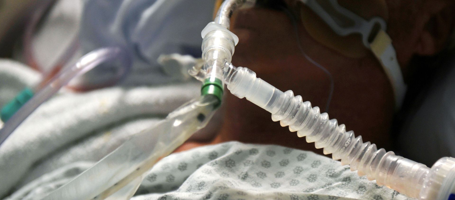 A patient on a ventilator is seen as medical professionals treat patients infected with the coronavirus disease (COVID-19) at United Memorial Medical Center in Houston, Texas, U.S., November 12, 2020 - Sputnik International, 1920, 11.02.2021