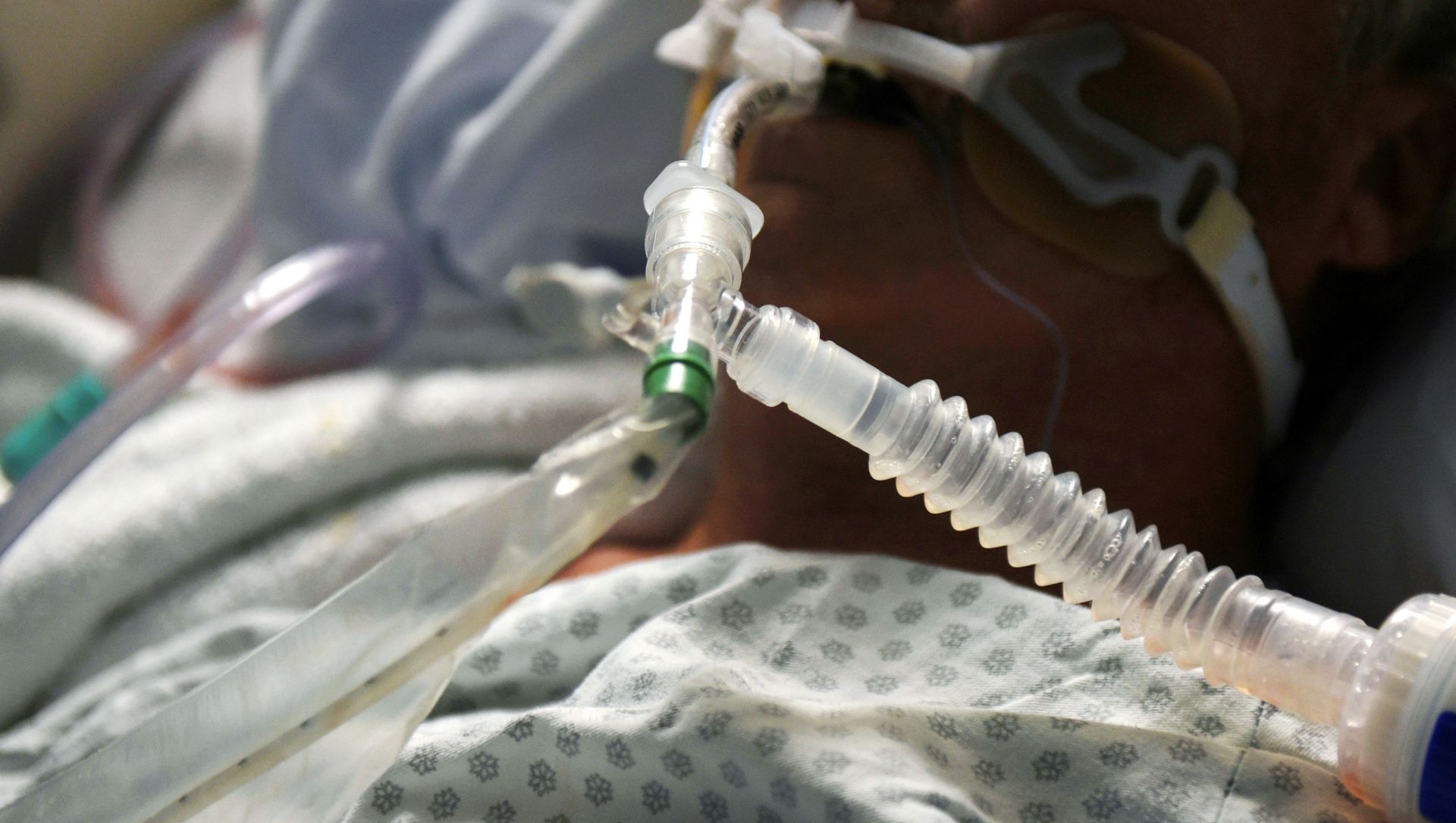 A patient on a ventilator is seen as medical professionals treat patients infected with the coronavirus disease (COVID-19) at United Memorial Medical Center in Houston, Texas, U.S., November 12, 2020 A patient on a ventilator is seen as medical professionals treat patients infected with the coronavirus disease (COVID-19) at United Memorial Medical Center in Houston, Texas, U.S., November 12, 2020 - Sputnik International, 1920, 11.02.2021