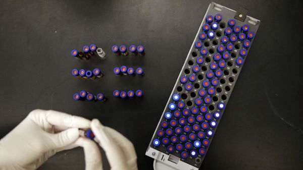 In this Aug. 10, 2015, photo, Christine Jelinek, a postdoctoral fellow at Johns Hopkins University, works alongside a tray of vials containing cerebral spinal fluid in Baltimore. Dr. Akhilesh Pandey, a researcher at Johns Hopkins University, said his research analyzes both adult and fetal tissue, and by identifying which proteins are present, he can get clues that could be used to help detect cancer in adults earlier. - Sputnik International