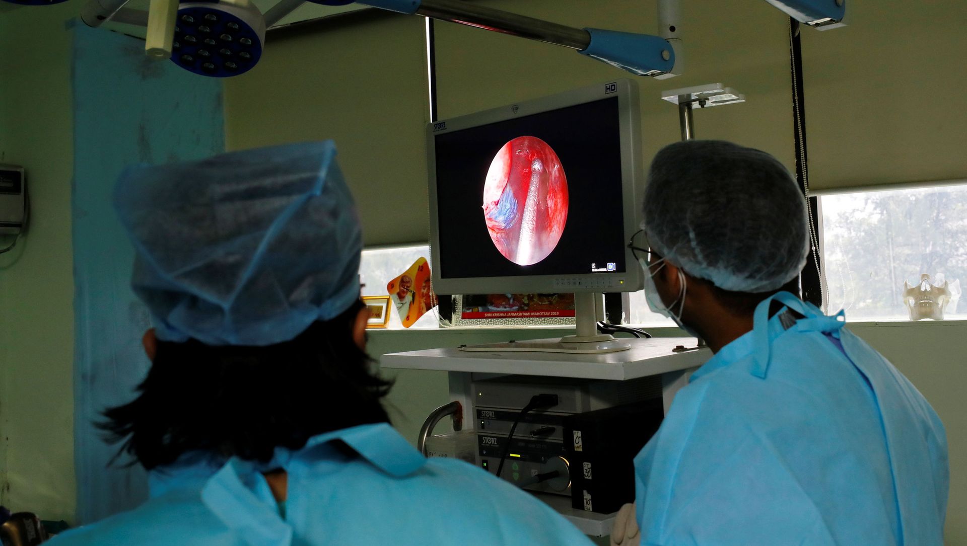Doctors perform endoscopic sinus surgery on Usha Arya, 56, who is suffering from Mucormycosis, also known as black fungus, at Harsh ENT hospital in Ghaziabad, on the outskirts of New Delhi, India May 31, 2021 Doctors perform endoscopic sinus surgery on Usha Arya, 56, who is suffering from Mucormycosis, also known as black fungus, at Harsh ENT hospital in Ghaziabad, on the outskirts of New Delhi, India May 31, 2021 - Sputnik International, 1920, 16.06.2021