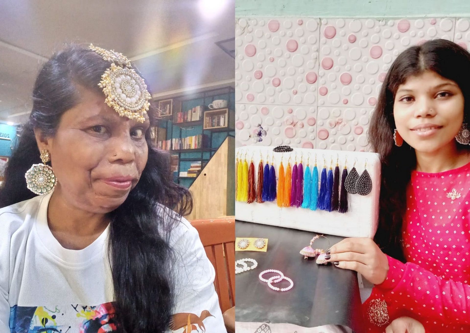 Indian Acid Attack Survivors Leave No Stone Unturned to Fight Hardship Amid COVID Crisis - Sputnik International, 1920, 20.06.2021