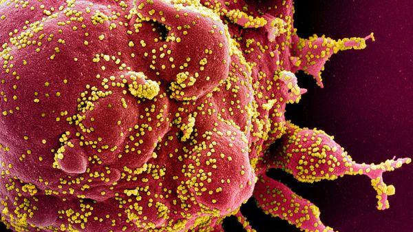 Colorized scanning electron micrograph of an apoptotic cell (red) infected with SARS-COV-2 virus particles (yellow), also known as novel coronavirus, isolated from a patient sample. Image captured at the NIAID Integrated Research Facility (IRF) in Fort Detrick, Maryland - Sputnik International