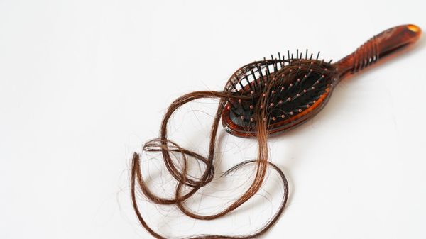 Hair loss - Sputnik International
