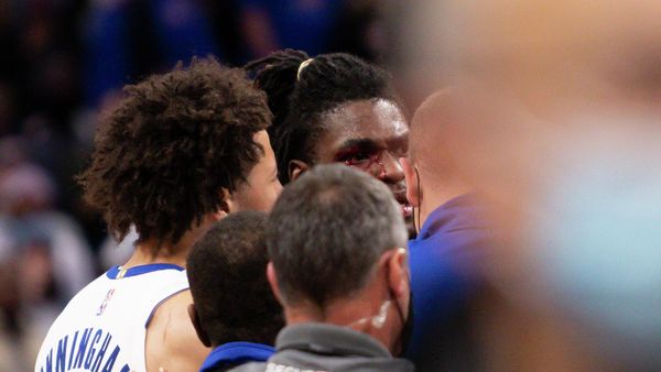 Nov 21, 2021; Detroit, Michigan, USA; Detroit Pistons center Isaiah Stewart (28) has blood around his right eye after an altercation with Los Angeles Lakers forward LeBron James (not pictured) during the third quarter at Little Caesars Arena. Mandatory Credit: Raj Mehta-USA TODAY Sports - Sputnik International