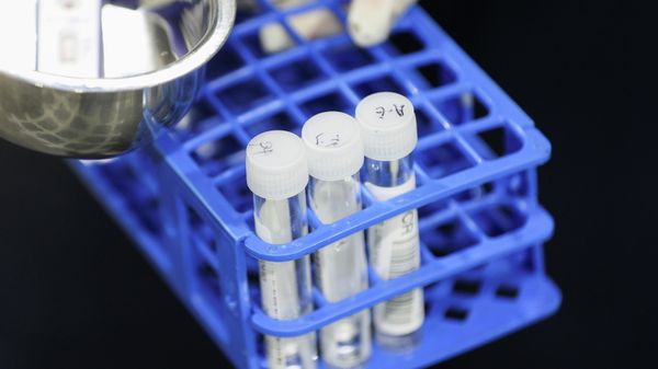 A medical worker carries RT-PCR swab tests at a pre-departure coronavirus disease (COVID-19) testing facility, as countries react to the new coronavirus Omicron variant, outside the international terminal at Sydney Airport in Sydney - Sputnik International