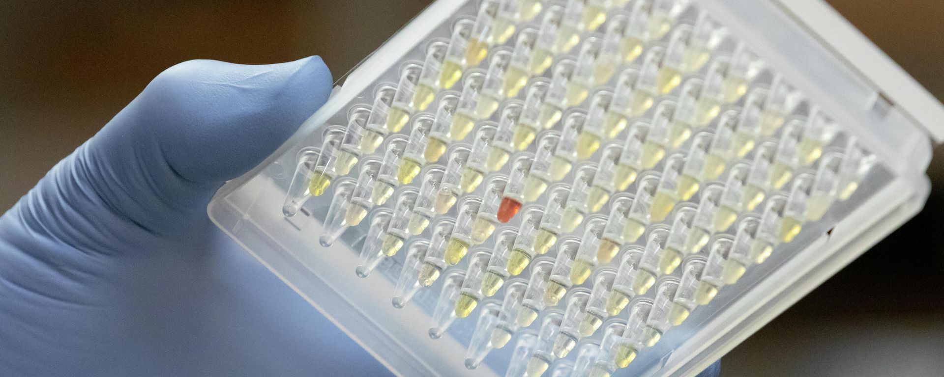 Daniel Streblow, Ph.D., holds a plate of plasma samples that contain COVID-19 antibodies, to be evaluated in OHSUХs in-house COVID-19 testing lab.  - Sputnik International, 1920, 20.05.2022