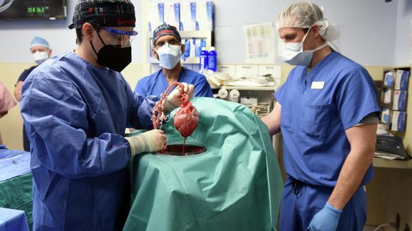Surgeon Muhammad M. Mohiuddin, MD leads a team placing a genetically-modified pig heart into a storage device at the Xenotransplant lab before its transplant on David Bennett, a 57-year-old patient with terminal heart disease, at University of Maryland Medical Center in Baltimore, Maryland, U.S. January 7, 2022. - Sputnik International