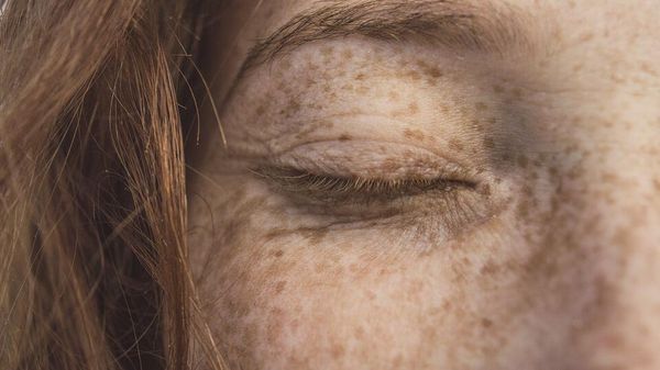 Freckles - Sputnik International