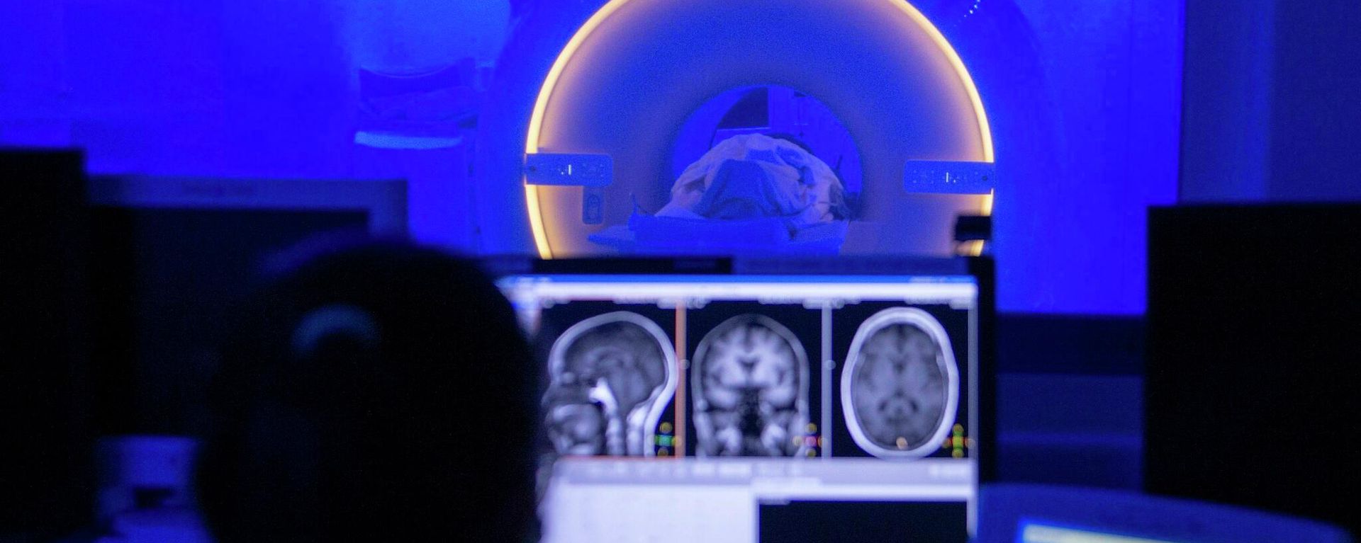 MRI scanning - Sputnik International, 1920, 09.03.2022