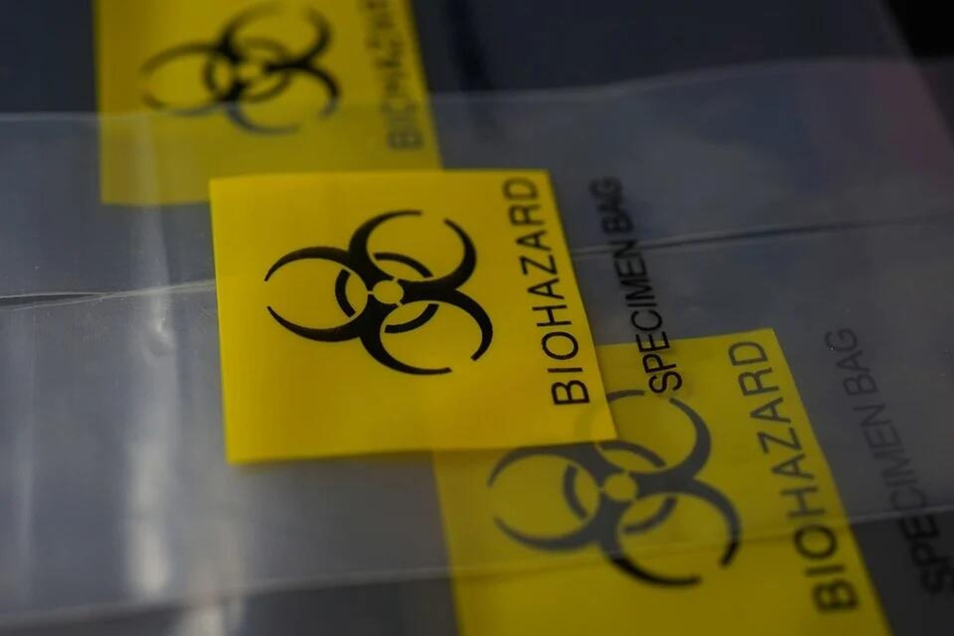 Biohazard
, - Sputnik International, 1920, 07.05.2022