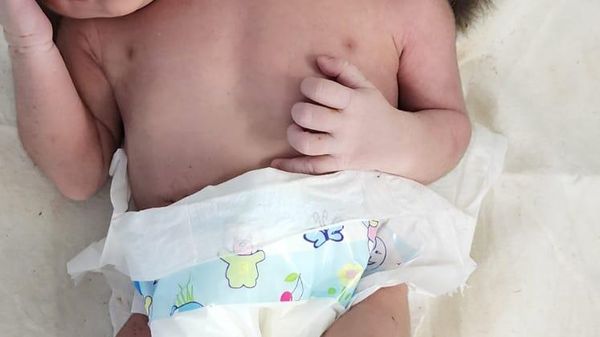 Picture of a baby born with two heads, three hands in India's Madhya Pradesh state's Ratlam district - Sputnik International