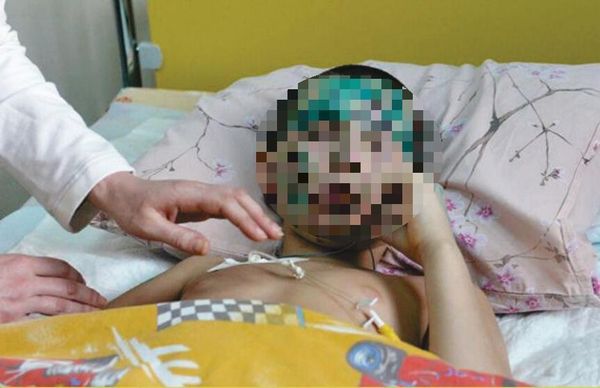 2 January 2015, Shakhtyorsk. Little Vanya Voronov lost his right arm and both legs as a result of artillery shelling by UAF war criminals. His younger brother Timofey, as well as his father, were killed on the spot. - Sputnik International