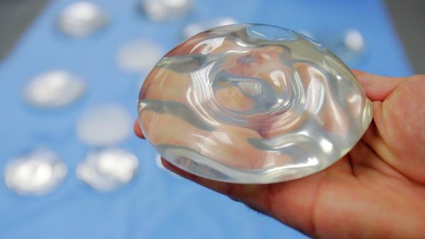 This Dec. 11, 2006 file photo shows a silicone gel breast implant in Irving, Texas. U.S. health officials are taking another look at the safety of breast implants, the latest review in a decades-long debate. At a two-day meeting that starts Monday, March 25, 2019, a panel of experts for the U.S. Food and Drug Administration will hear from researchers, plastic surgeons and implant makers, as well as from women who believe their ailments were caused by the implants.  - Sputnik International