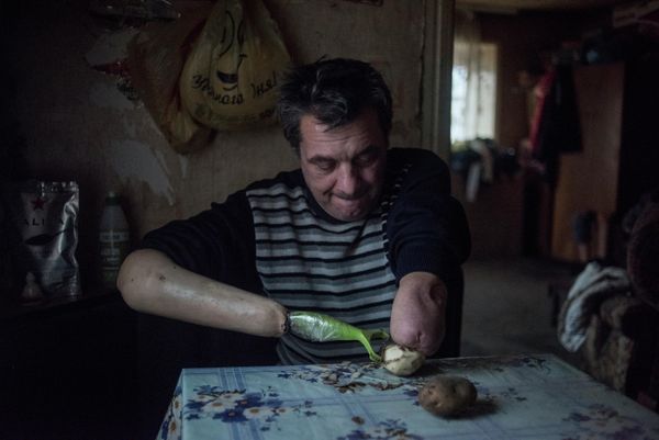51-year-old Yuri Yanush, who lost both arms before the war, peels potatoes. He lives in the village of Gurty outside the city of Donetsk. Single people with handicaps have no one to depend on, and have no hope of receiving normal medical care. Many cannot find employment. Regular shelling is the reality in which people who already live difficult lives even in times of peace are forced to exist. - Sputnik International