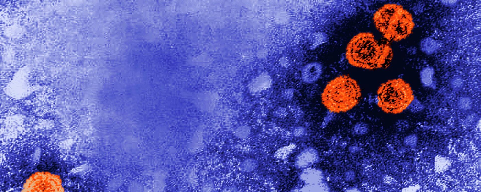 This 1981 electron microscope image made available by the U.S. Centers for Disease Control and Prevention shows hepatitis B virus particles, indicated in orange. This 1981 electron microscope image made available by the U.S. Centers for Disease Control and Prevention shows hepatitis B virus particles, indicated in orange. - Sputnik International, 1920, 16.08.2023