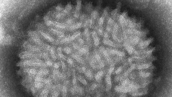 Monkeypox  - Sputnik International