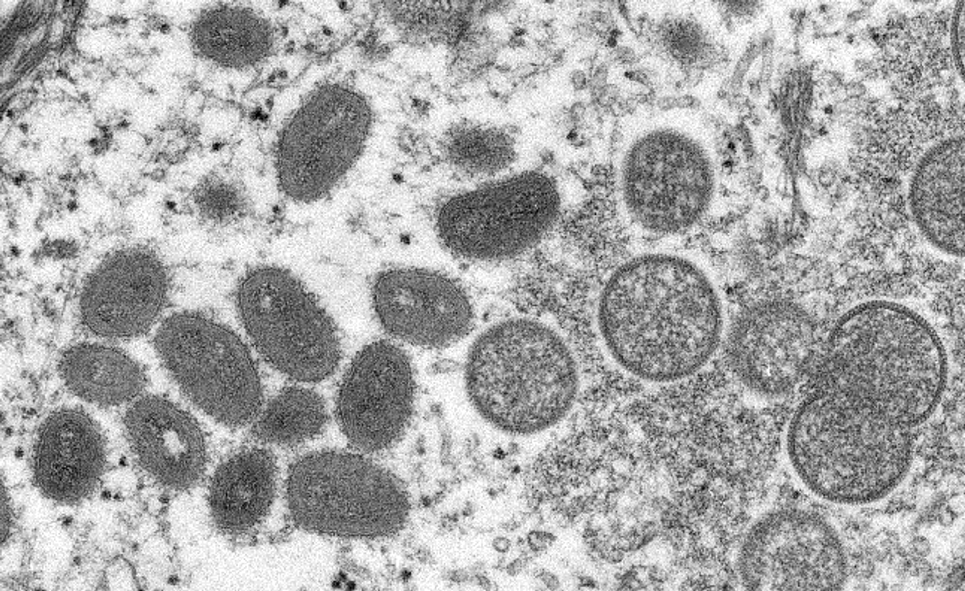Monkeypox sample - Sputnik International, 1920, 21.07.2022