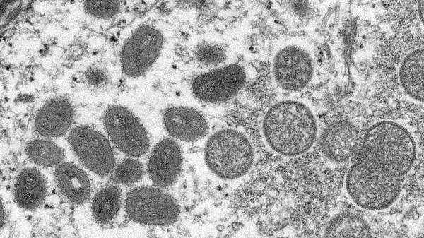 Monkeypox sample - Sputnik International