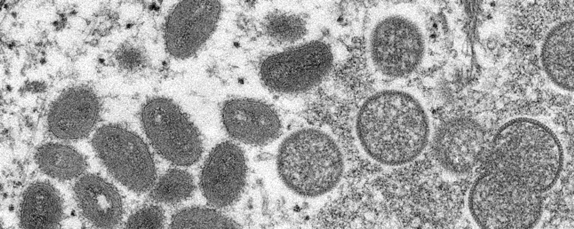 Monkeypox sample Monkeypox sample - Sputnik International, 1920, 27.05.2022
