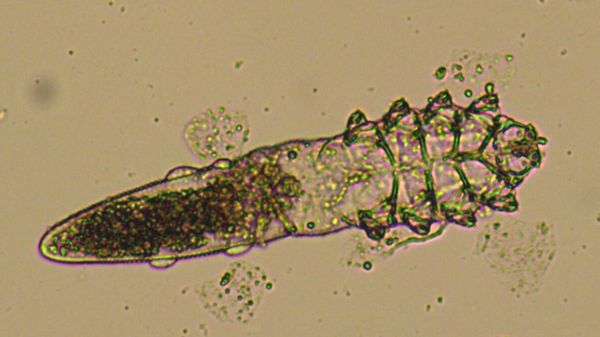 Dermatological human parasite mite Demodex follicularum - Sputnik International