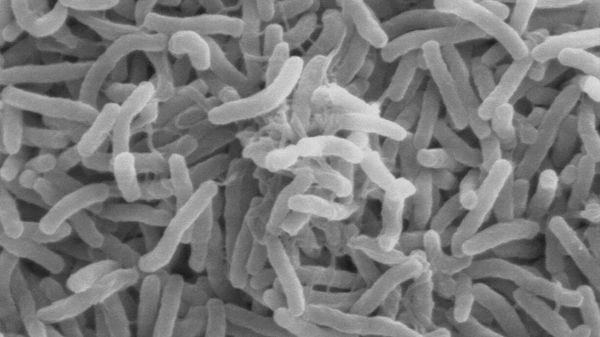 Cholera bacteria  - Sputnik International