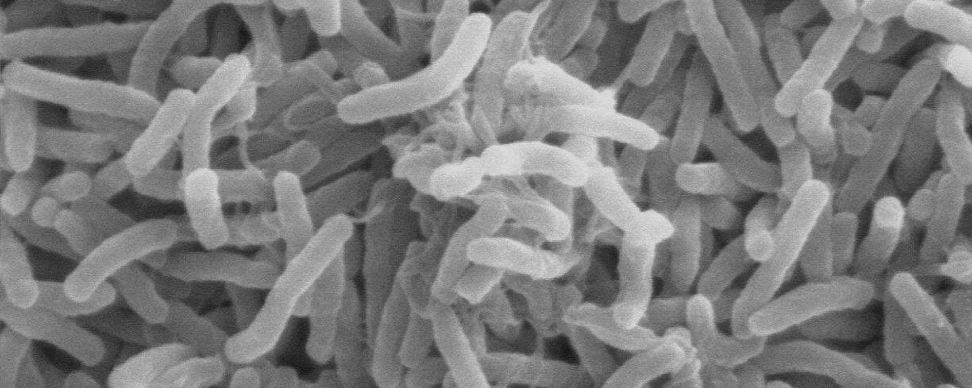 Cholera bacteria  - Sputnik International, 1920, 22.06.2022