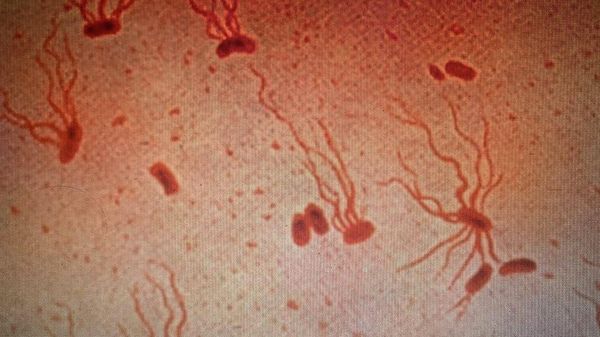 Salmonella enterica serovar Typhi flagellar stain - Sputnik International