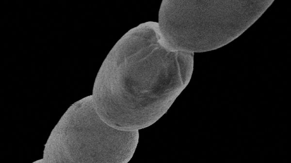 This handout image released by Lawrence Berkeley National Laboratory on June 23, 2022, shows a 3D microscope image of giant bacteria Ca Thiomargarita magnifica - Sputnik International