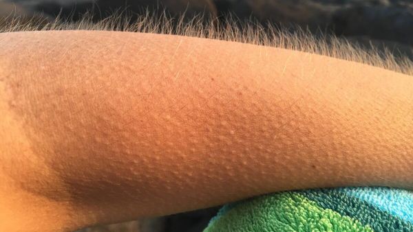 Goosebumps - Sputnik International